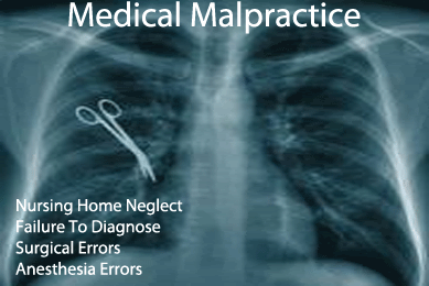 Medical malpractice — surgical error X-ray