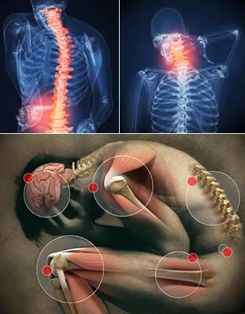 Personal injury — spine and body injuries